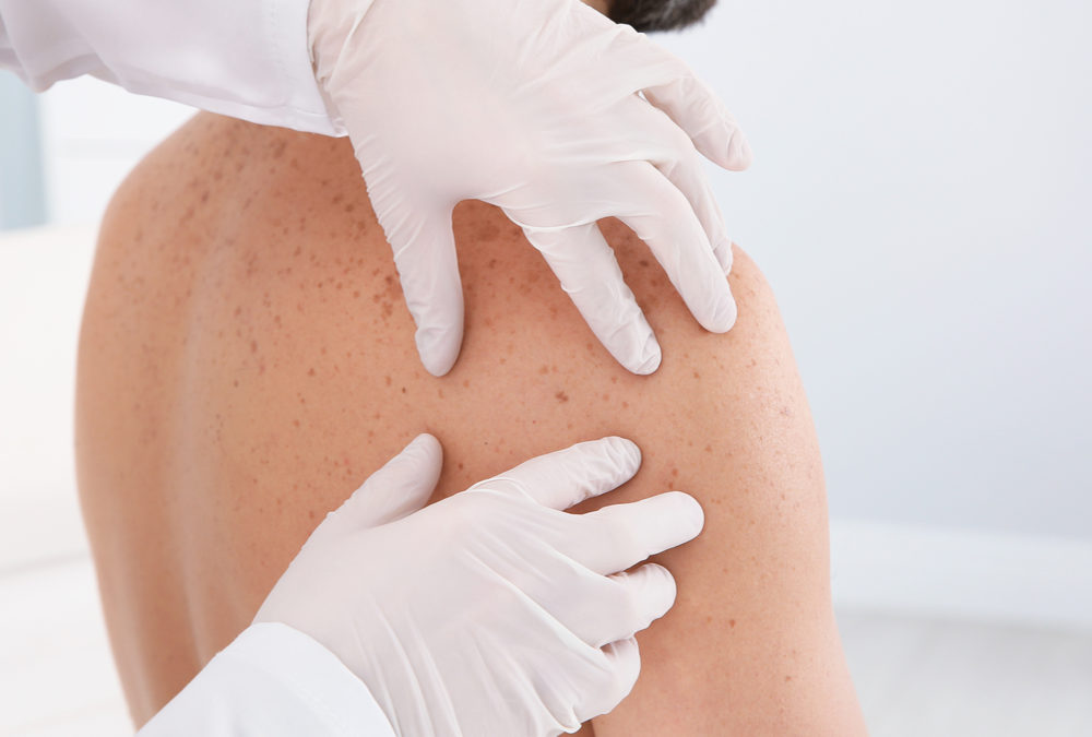Project continues to reduce demand for 2WW dermatology referrals – now by 28%