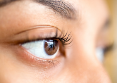 Optometrist case study: Ophthalmology