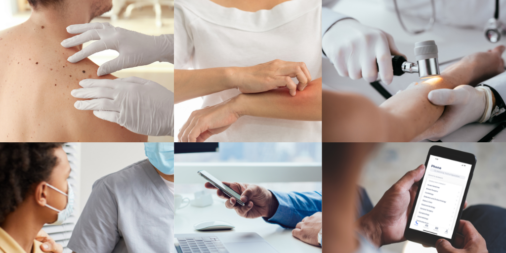 Case Studies: Teledermatology via Consultant Connect - Consultant Connect