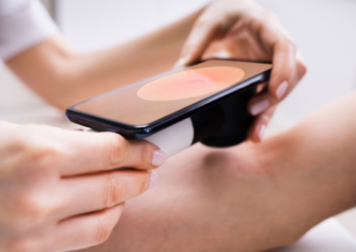 Teledermatology Advice & Guidance in Surrey