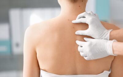 How Consultant Connect is supporting Dermatology referrals in Calderdale